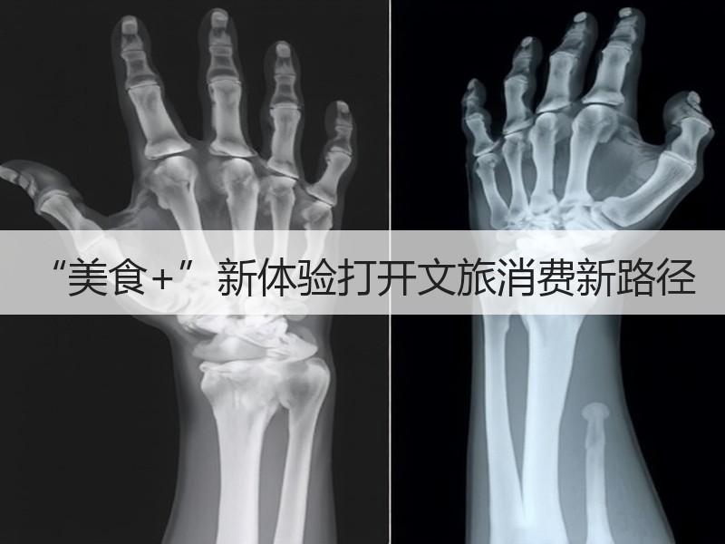“美食+”新体验打开文旅消费新路径 - 安枢游走吧旅游科普资讯网